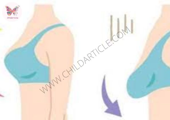 How To Prevent Sagging Of Breasts | ChildArticle